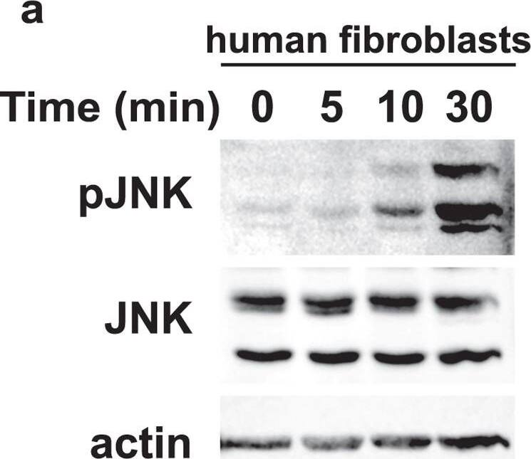 Detection of Human JNK1/2/3 by Western Blot