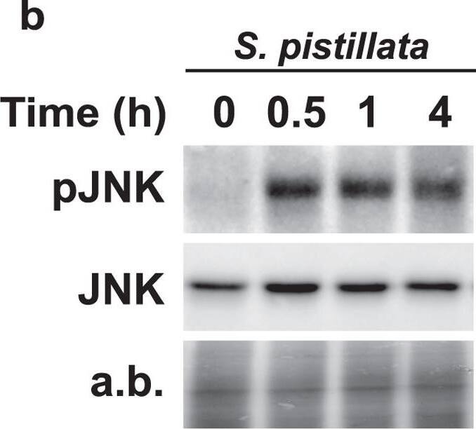 Detection of Human JNK1/2/3 by Western Blot