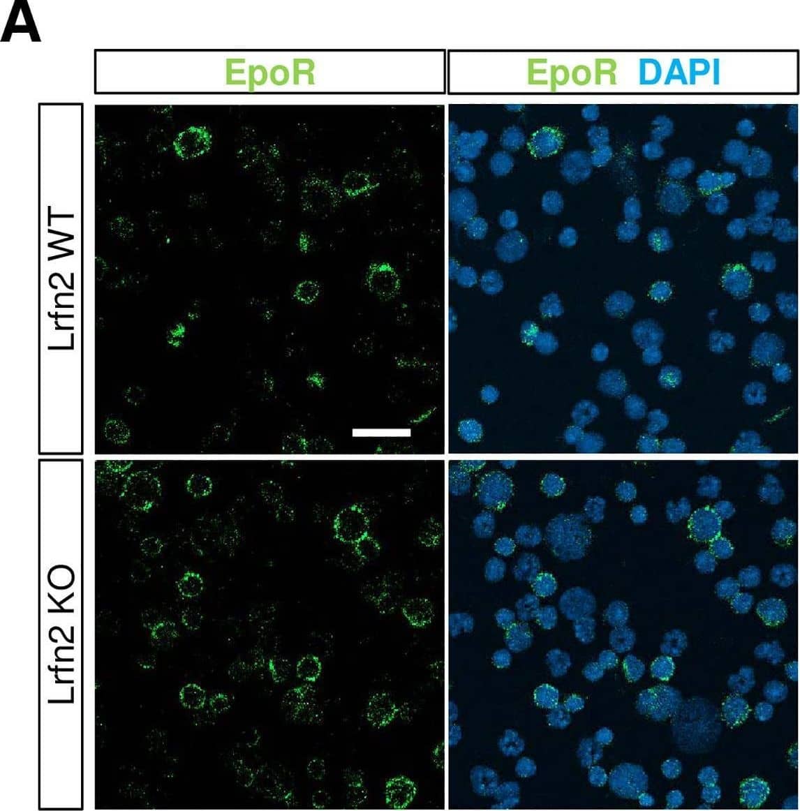 Detection of Erythropoietin R by Immunocytochemistry/ Immunofluorescence