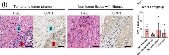 Detection of Osteopontin/OPN by Immunohistochemistry