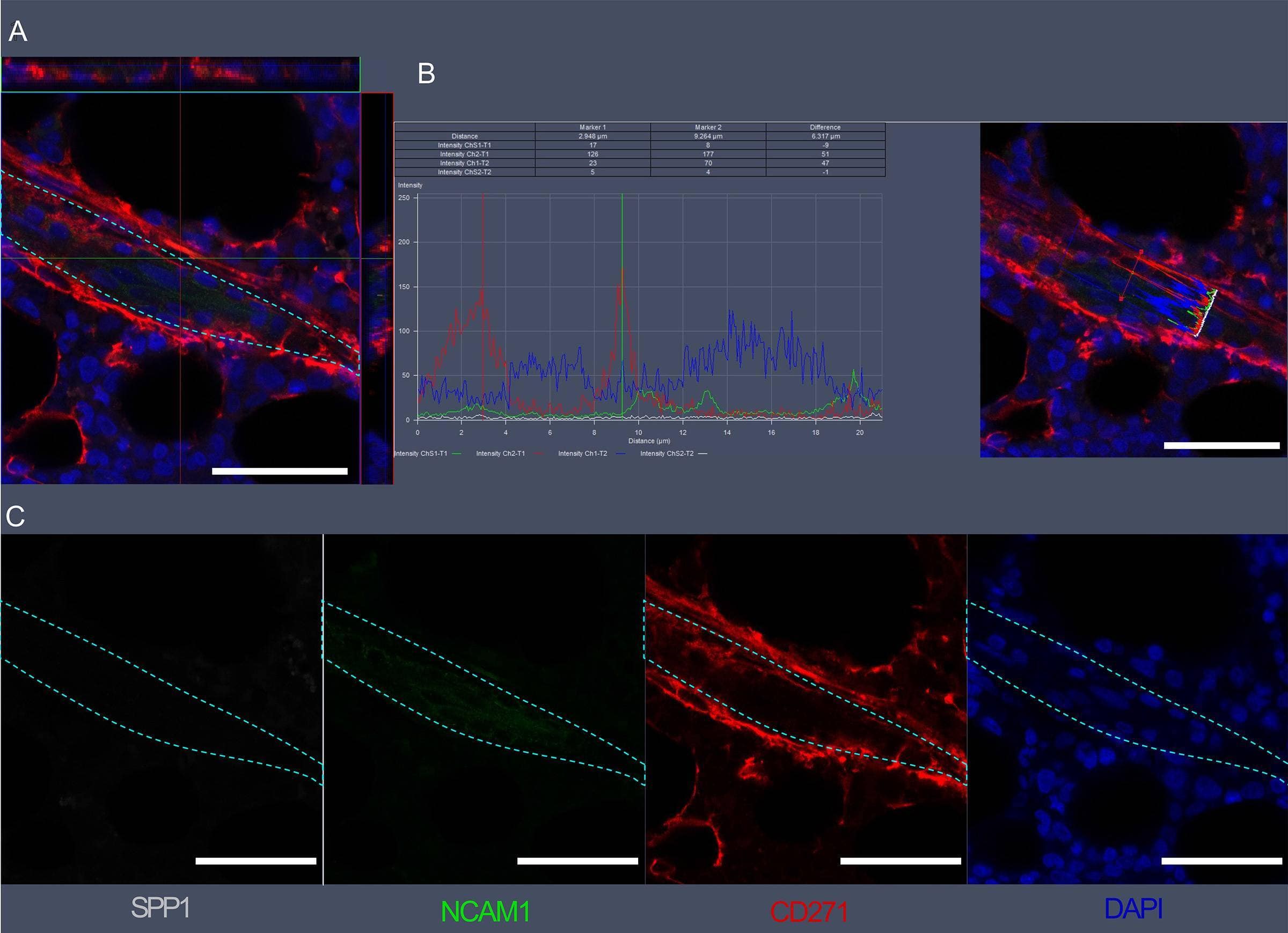 Detection of Osteopontin/OPN by Immunohistochemistry