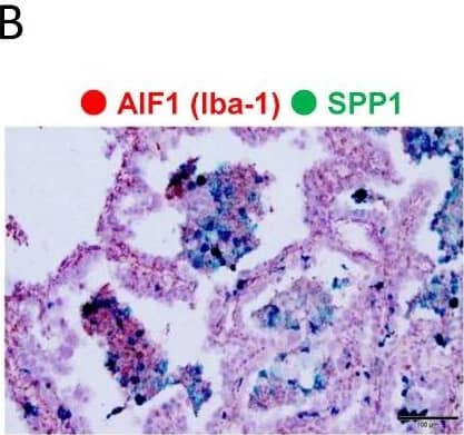 Detection of Osteopontin/OPN by Immunohistochemistry