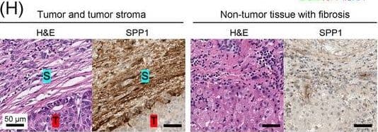 Detection of Osteopontin/OPN by Immunohistochemistry