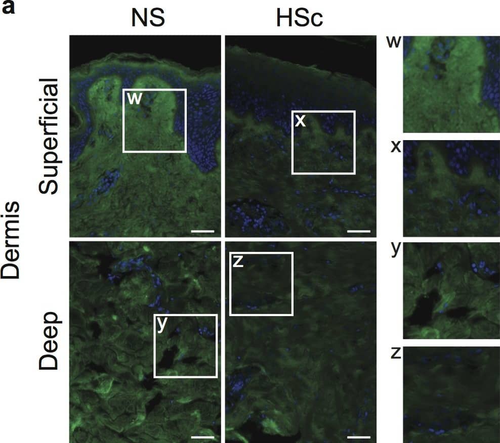 Detection of Human Decorin by Immunocytochemistry/ Immunofluorescence