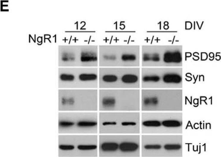 Detection of Mouse Nogo Receptor/NgR by Western Blot