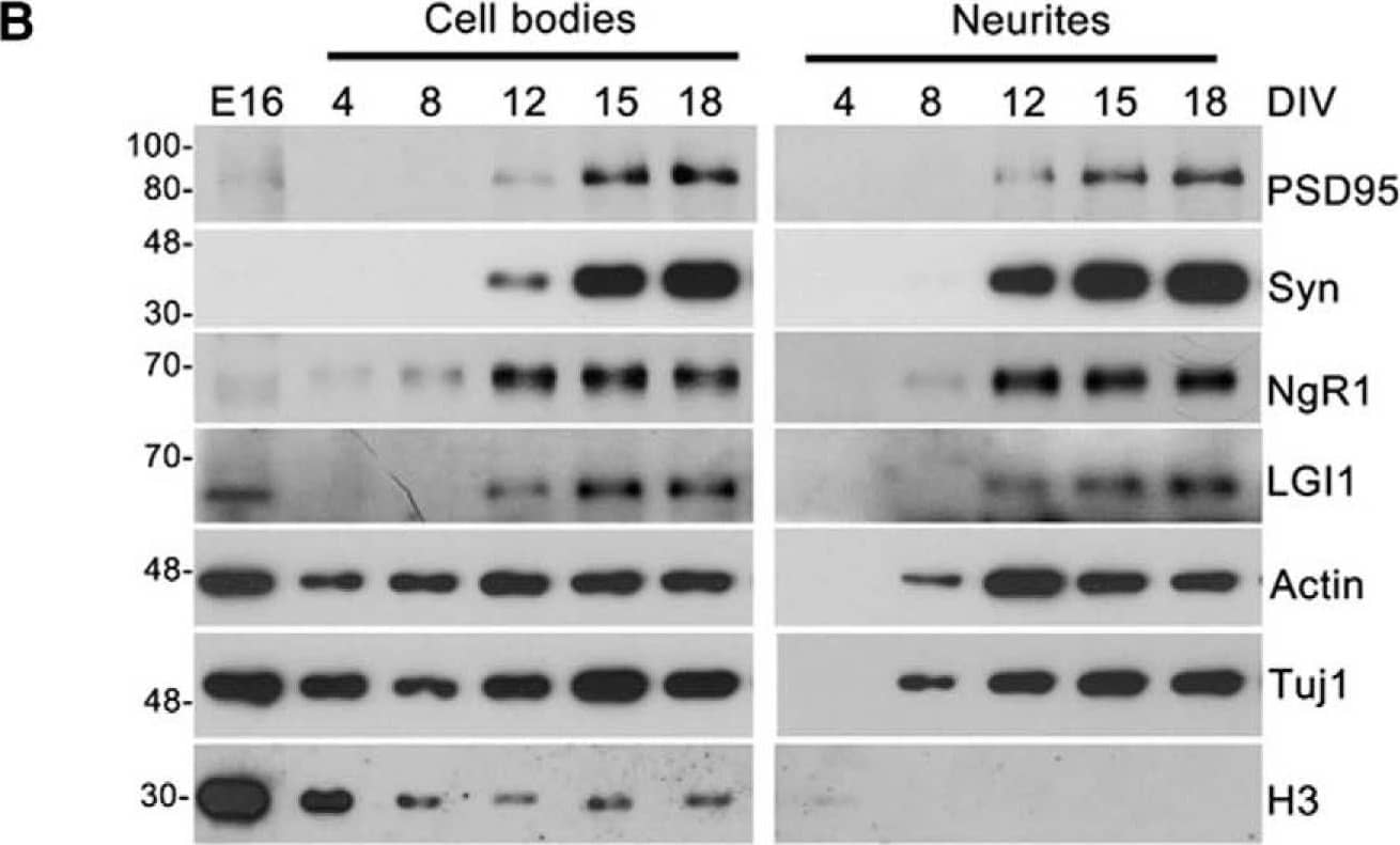 Detection of Mouse Nogo Receptor/NgR by Western Blot