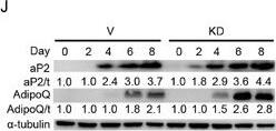 Detection of FABP4/A-FABP by Western Blot