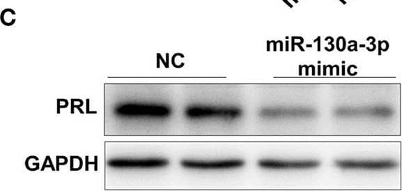 Detection of Prolactin by Western Blot