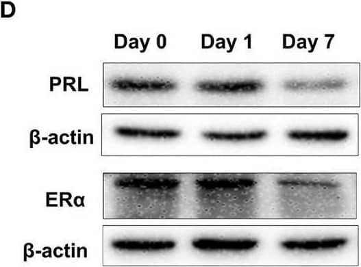 Detection of Prolactin by Western Blot