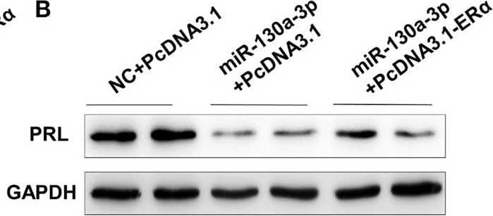 Detection of Prolactin by Western Blot