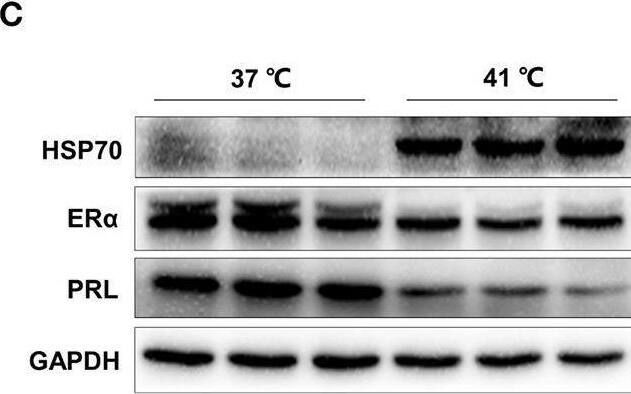 Detection of Prolactin by Western Blot