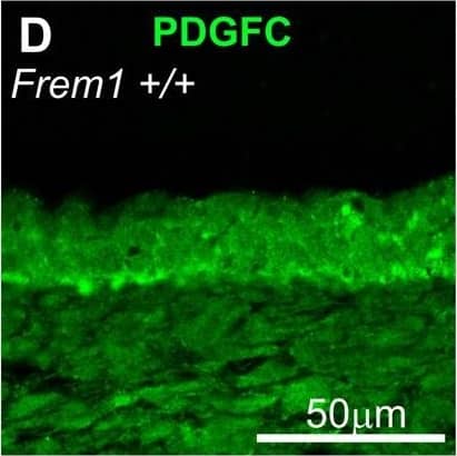 Detection of Mouse PDGF-C by Immunocytochemistry/ Immunofluorescence