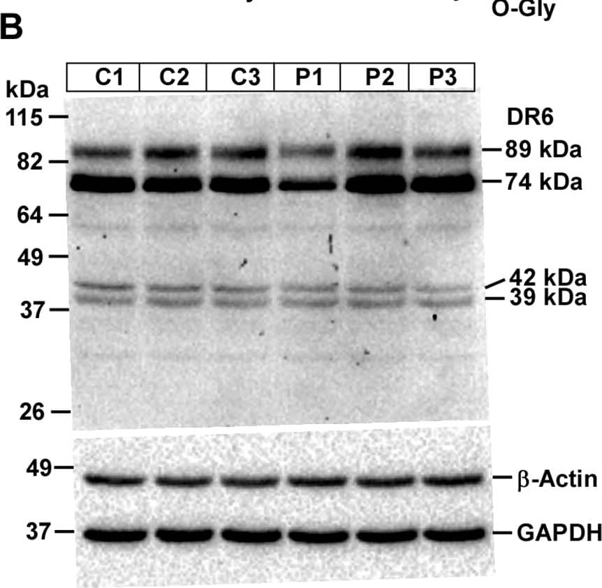 Detection of DR6/TNFRSF21 by Western Blot