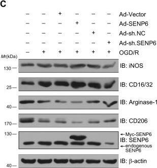 Detection of Fc gamma RII/RIII (CD32/CD16) by Western Blot