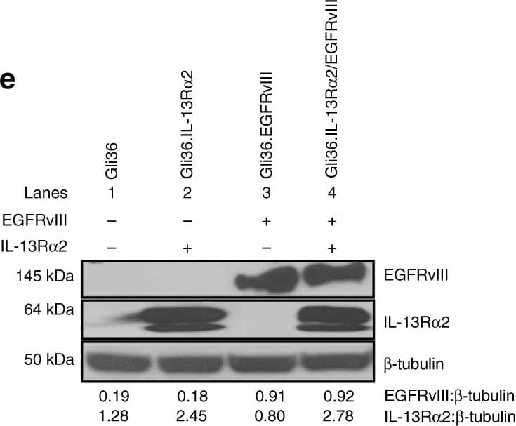 Detection of Human IL-13R alpha 2 by Western Blot