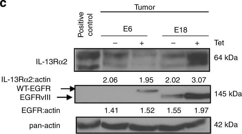 Detection of Human IL-13R alpha 2 by Western Blot