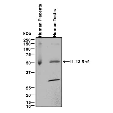 Detection of Human IL-13 Ra2 antibody by Western Blot.
