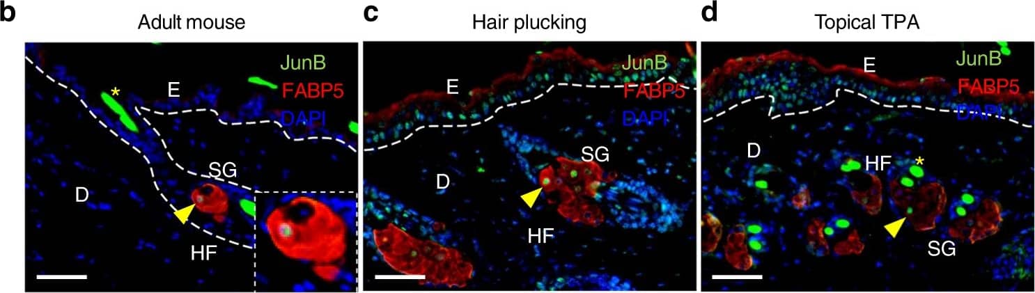 Detection of Mouse FABP5/E-FABP by Immunohistochemistry