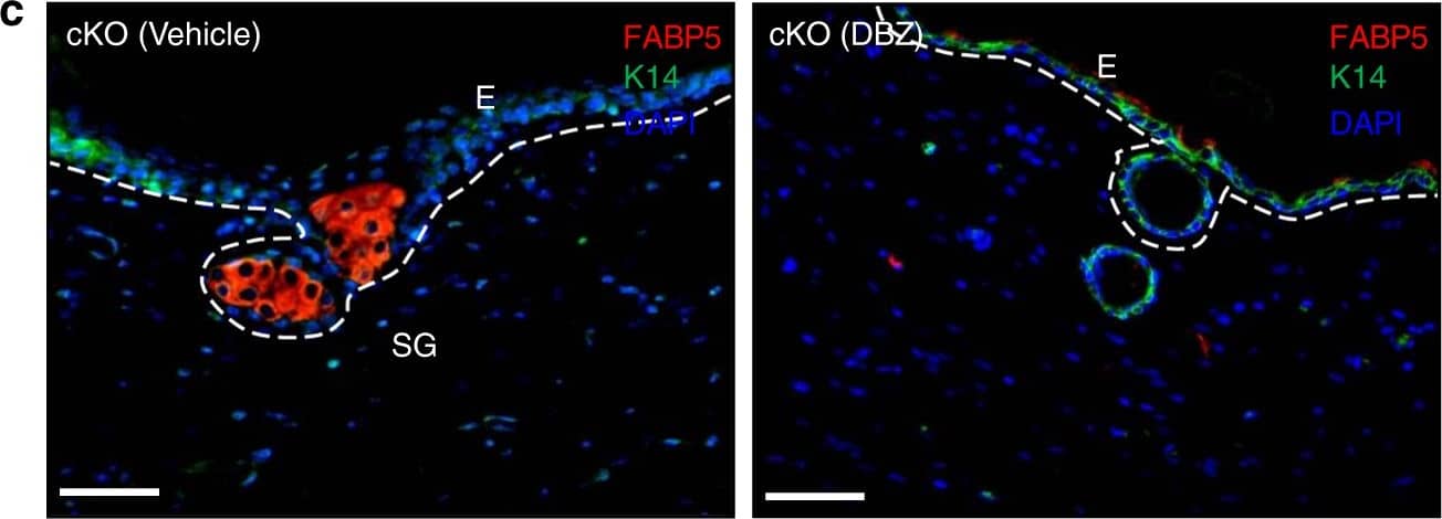 Detection of Mouse FABP5/E-FABP by Immunohistochemistry