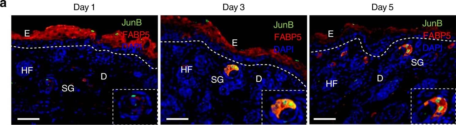 Detection of Mouse FABP5/E-FABP by Immunohistochemistry