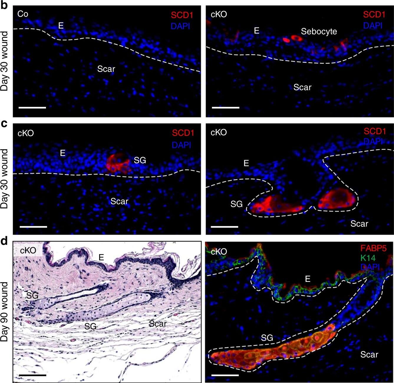 Detection of Mouse FABP5/E-FABP by Immunocytochemistry/ Immunofluorescence
