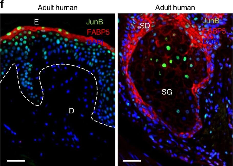 Detection of Mouse FABP5/E-FABP by Immunohistochemistry