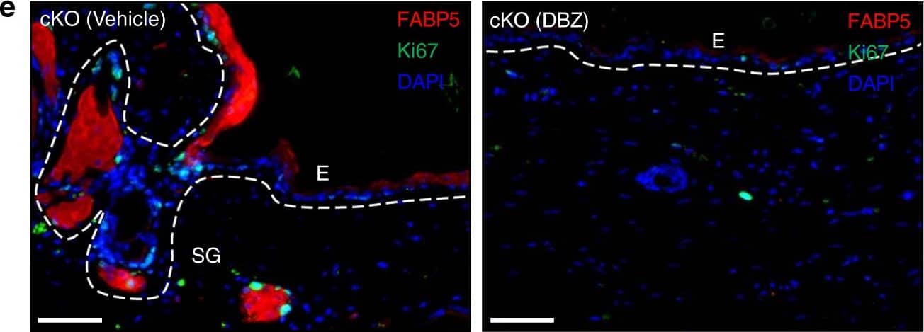 Detection of Mouse FABP5/E-FABP by Immunohistochemistry