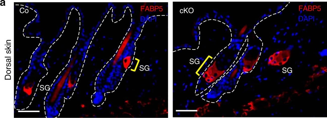 Detection of Mouse FABP5/E-FABP by Immunocytochemistry/ Immunofluorescence