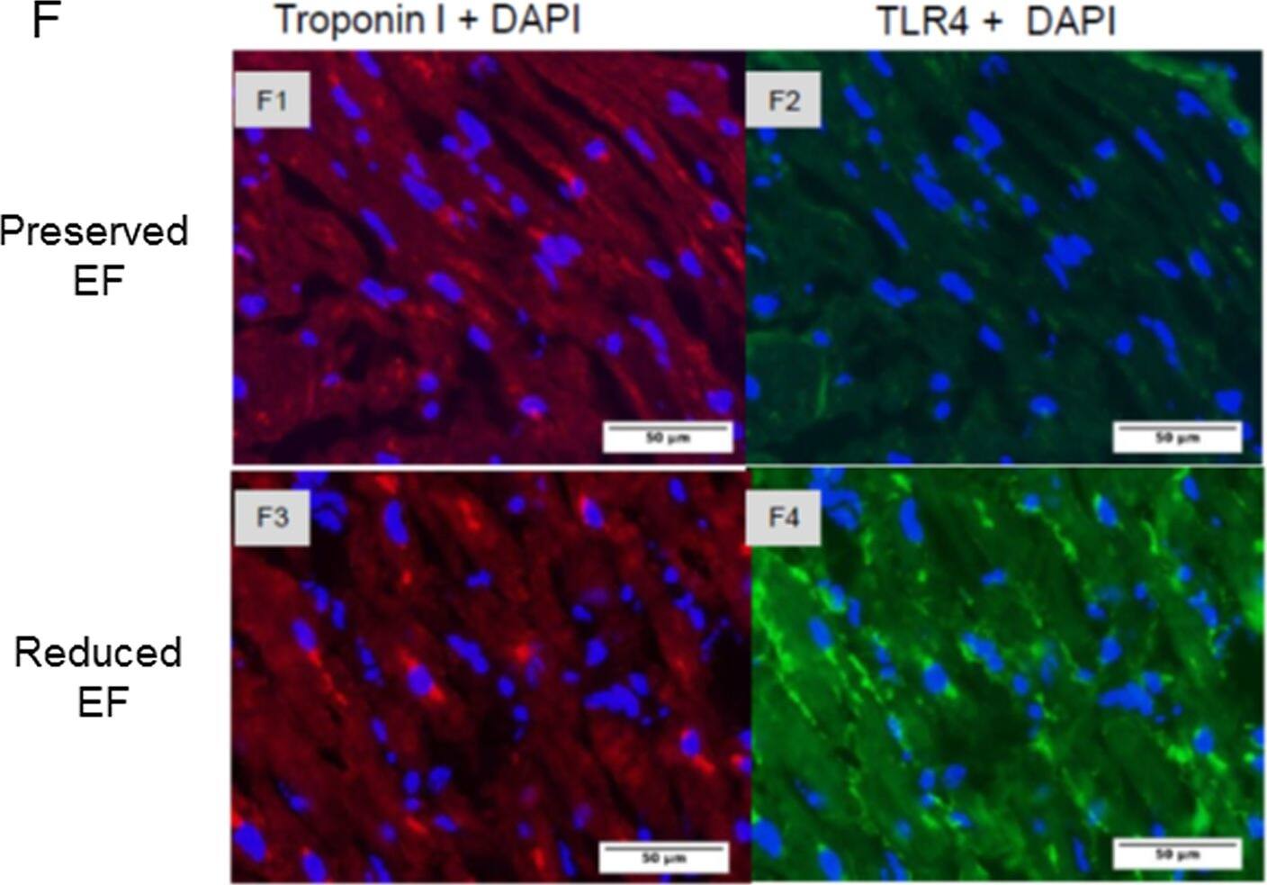 Detection of Human TLR4 by Immunocytochemistry/ Immunofluorescence