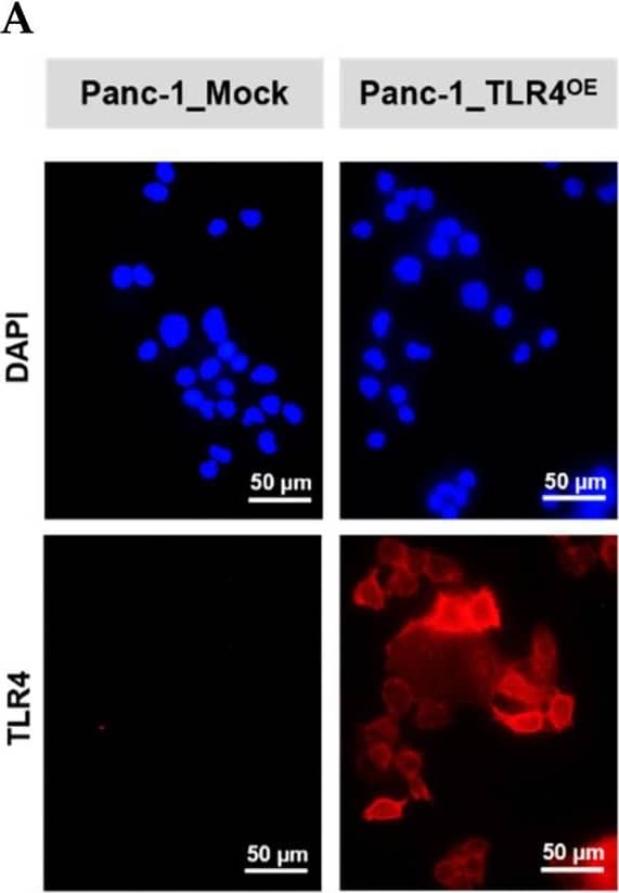 Detection of TLR4 by Immunocytochemistry/ Immunofluorescence