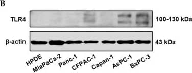 Detection of TLR4 by Western Blot