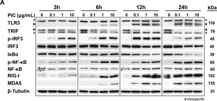 Detection of Human TLR3 by Western Blot