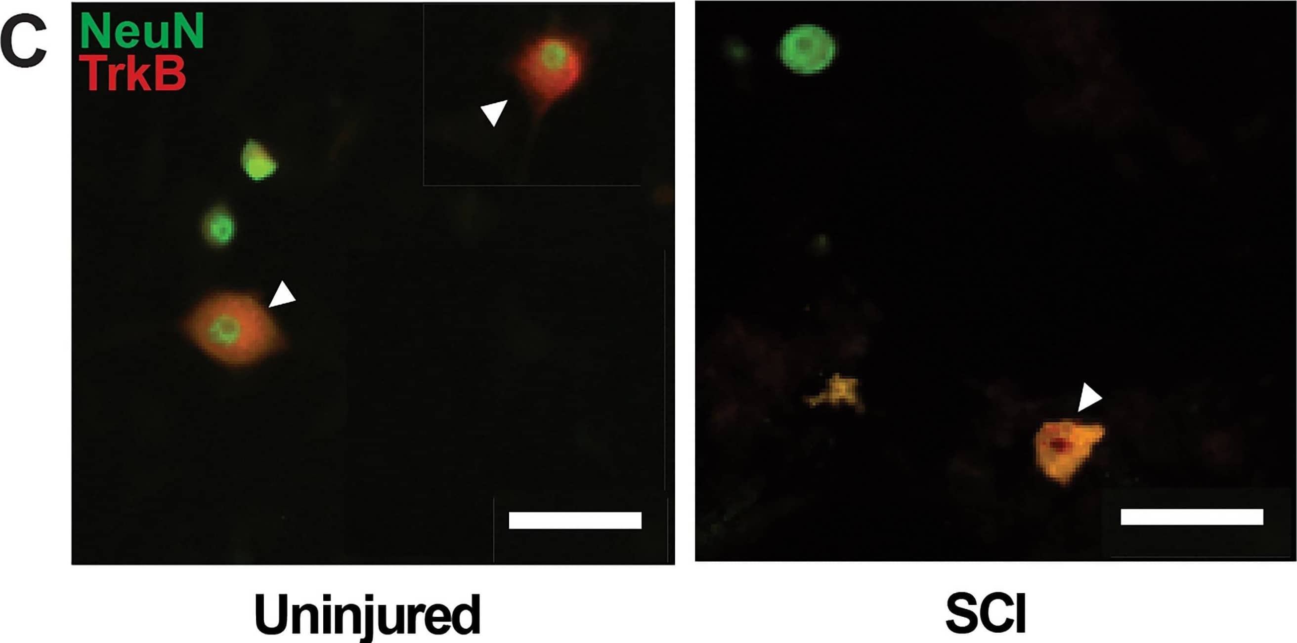 Detection of TrkB by Immunocytochemistry/ Immunofluorescence