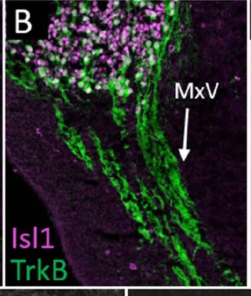 Detection of Mouse TrkB by Immunohistochemistry