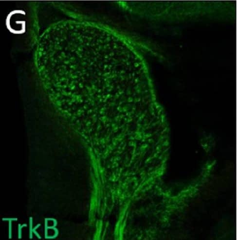 Detection of Mouse TrkB by Immunohistochemistry