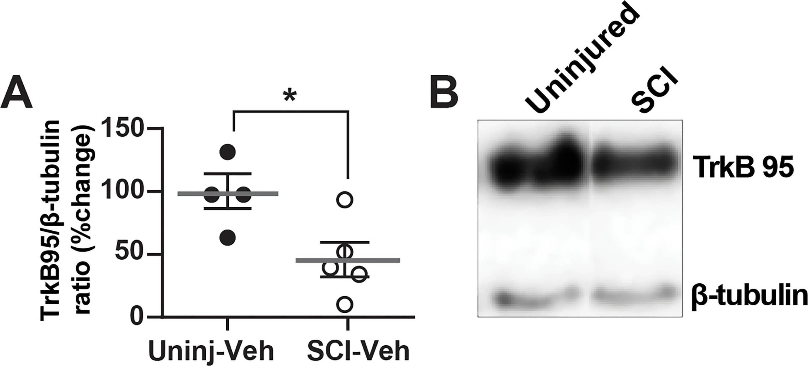 Detection of TrkB by Western Blot