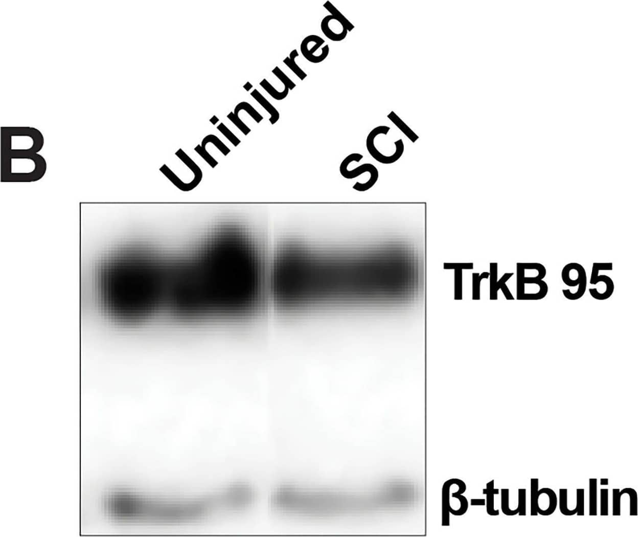 Detection of TrkB by Western Blot