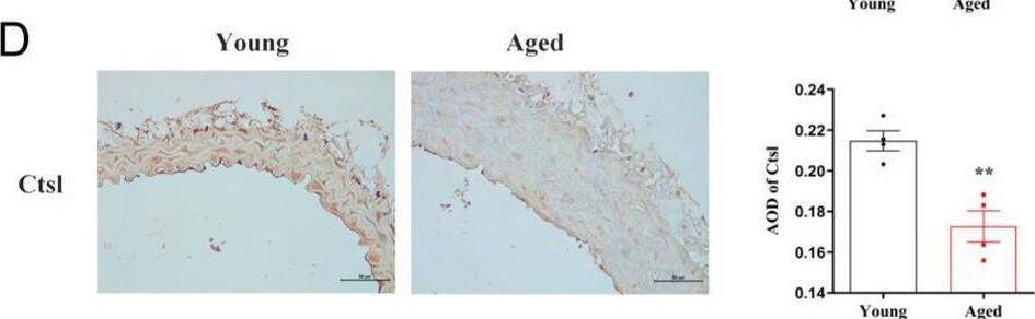 Detection of Cathepsin L by Immunohistochemistry