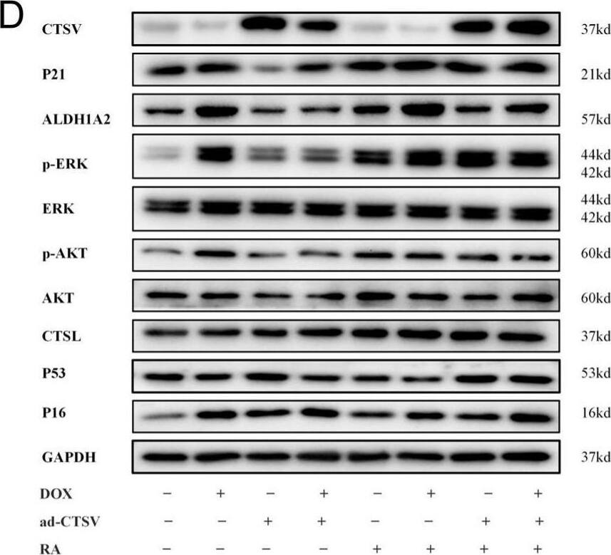 Detection of Cathepsin L by Western Blot