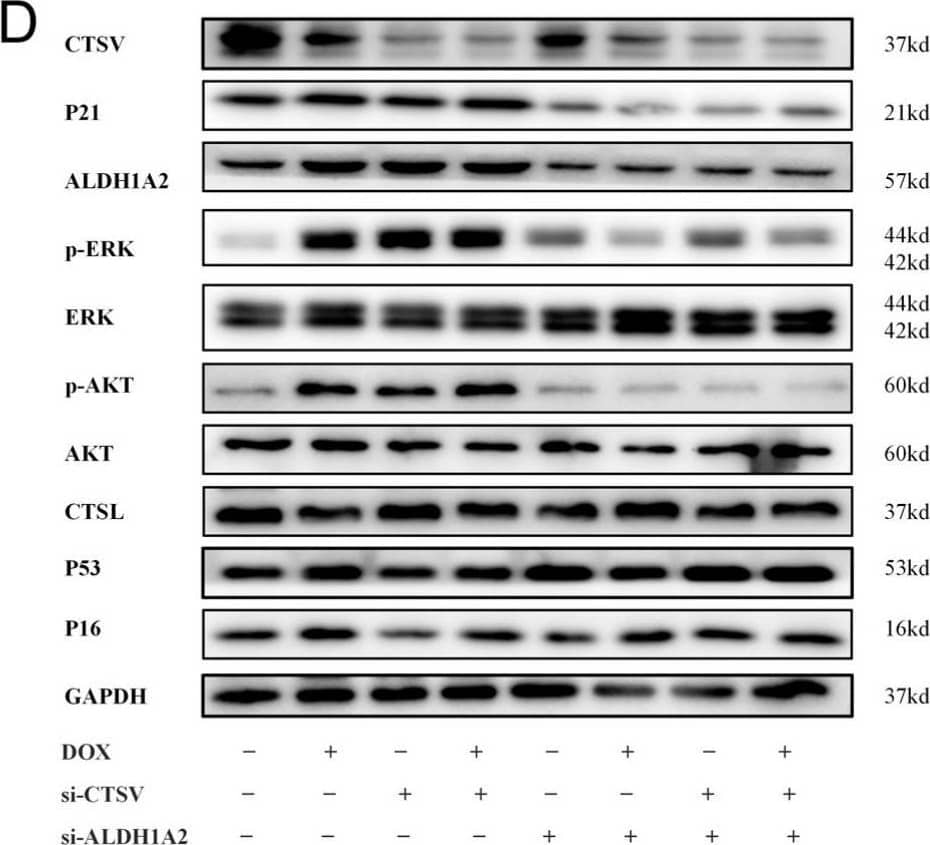 Detection of Cathepsin L by Western Blot