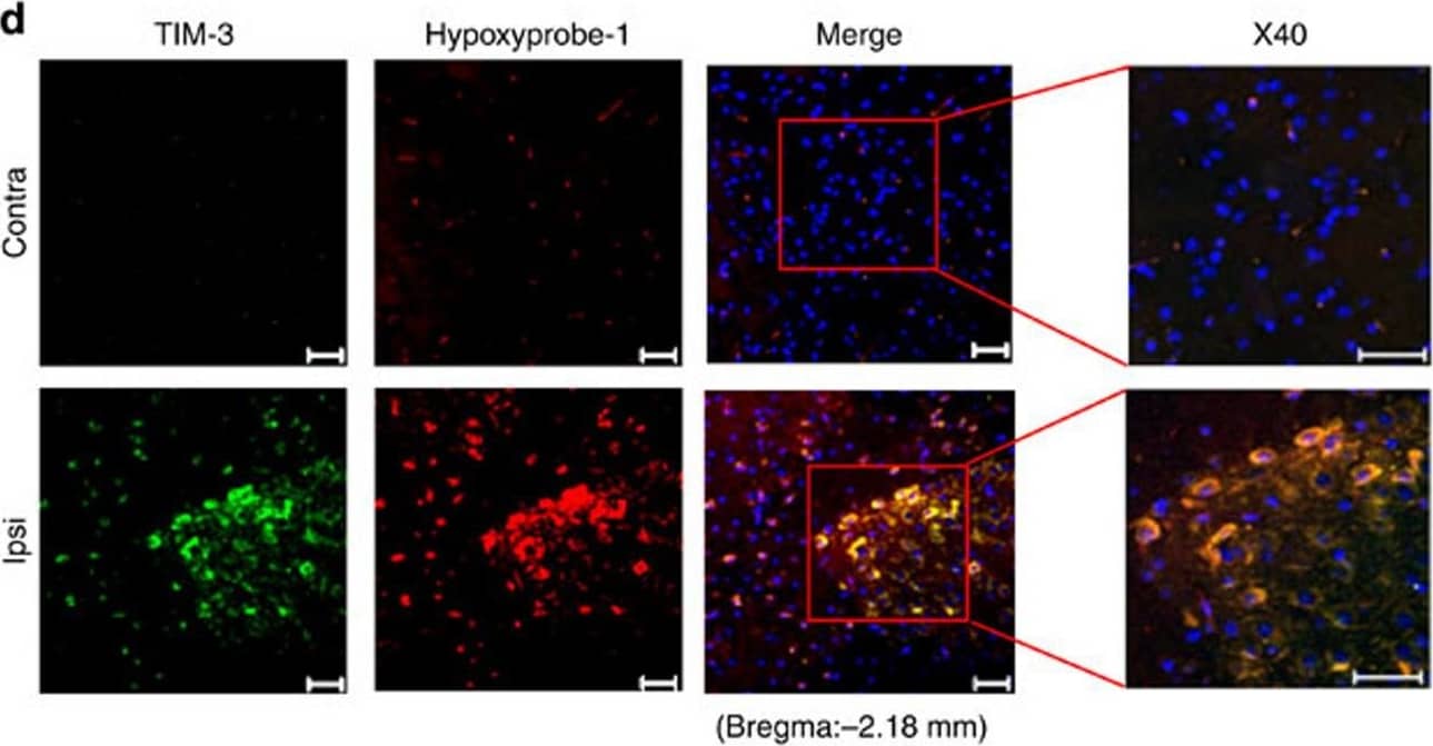 Detection of Mouse TIM-3 by Immunohistochemistry