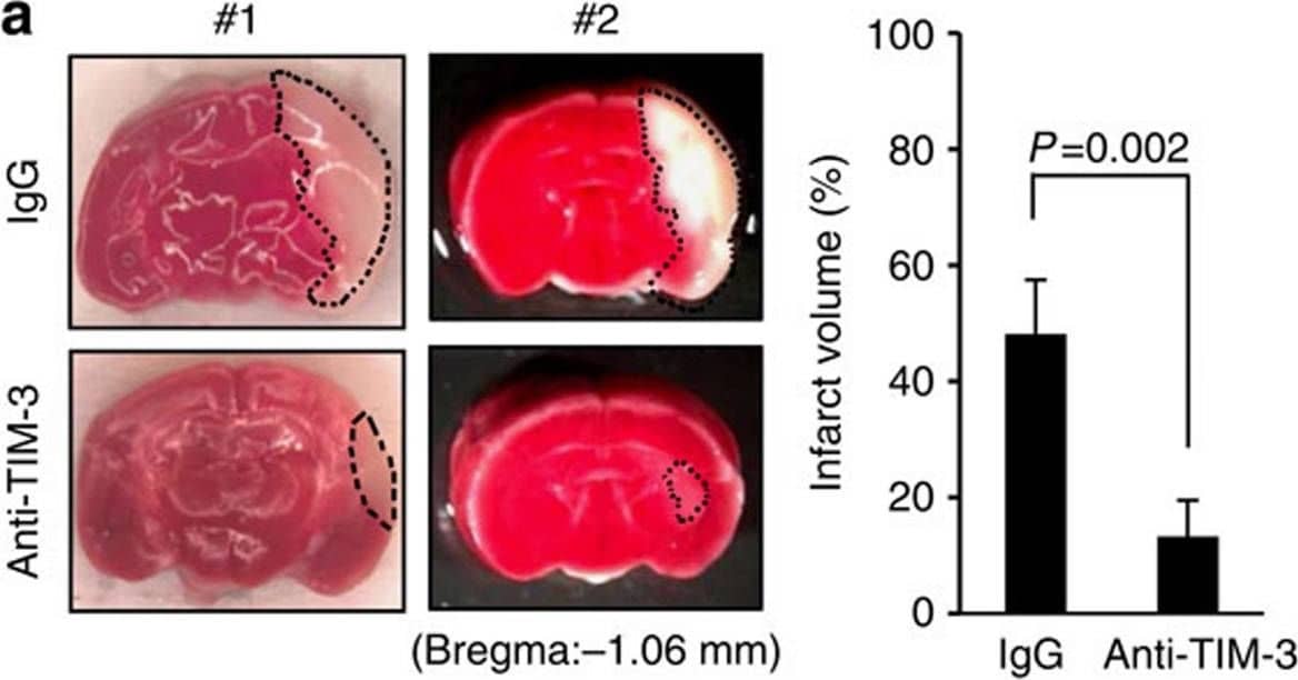 Detection of Mouse TIM-3 by Immunohistochemistry