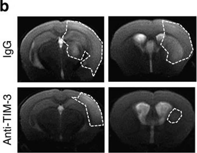 Detection of Mouse TIM-3 by Immunohistochemistry