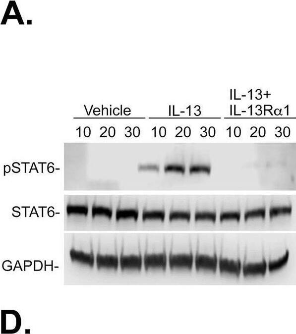 Detection of IL-13 R alpha 1 by Western Blot