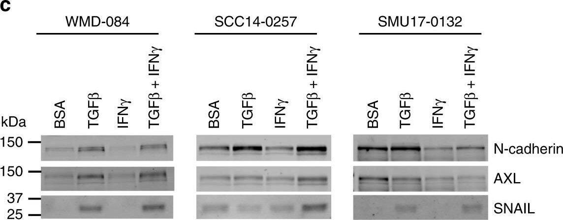 Detection of Human Axl by Western Blot