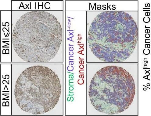 Detection of Human Axl by Immunohistochemistry