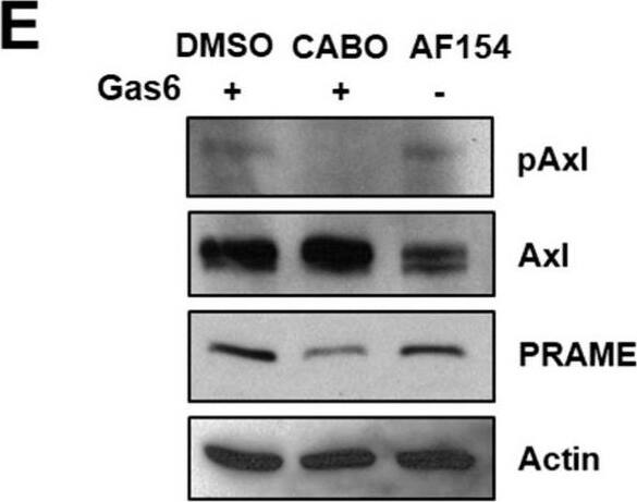 Detection of Axl by Western Blot