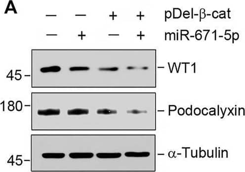 Detection of Podocalyxin by Western Blot