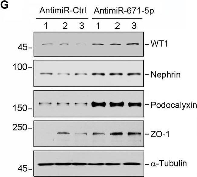 Detection of Podocalyxin by Western Blot
