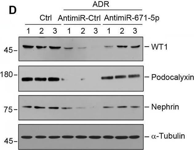 Detection of Podocalyxin by Western Blot